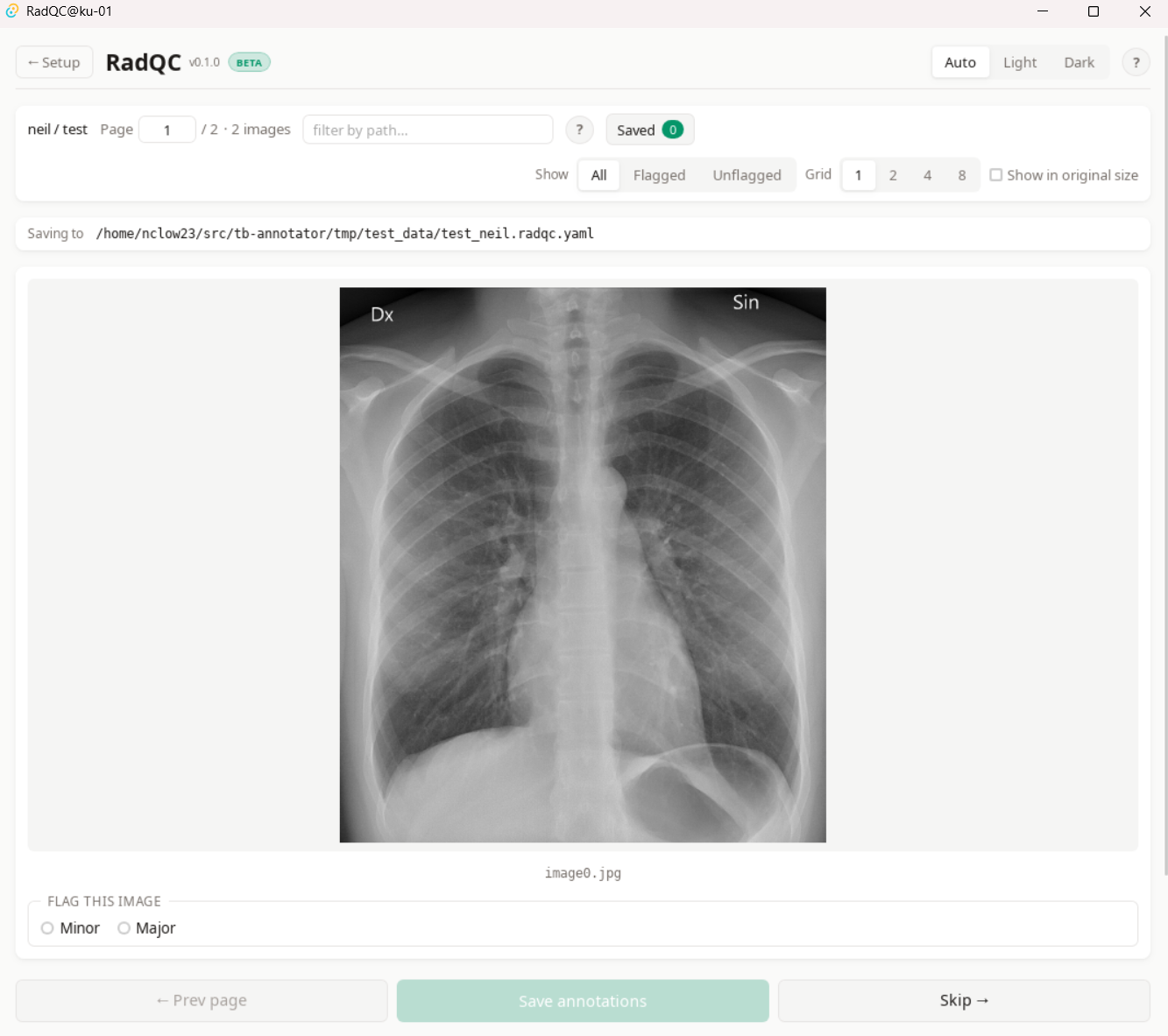 Annotation view with the flag controls