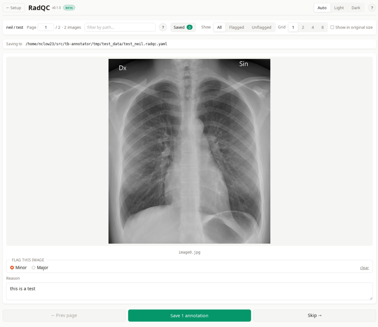 Annotation view after a flag is selected, with the Reason field visible