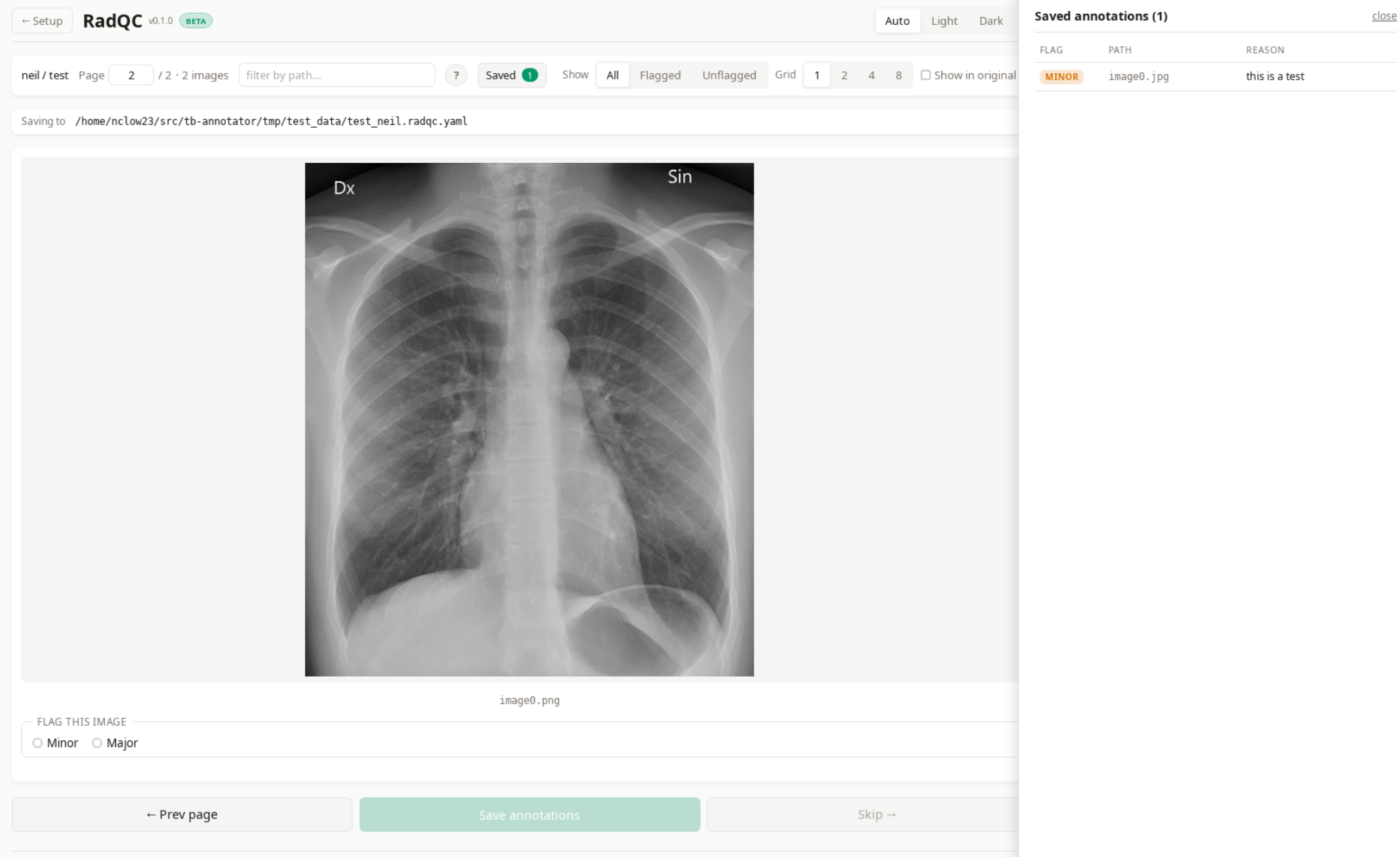 Saved confirmation tag on an annotated image