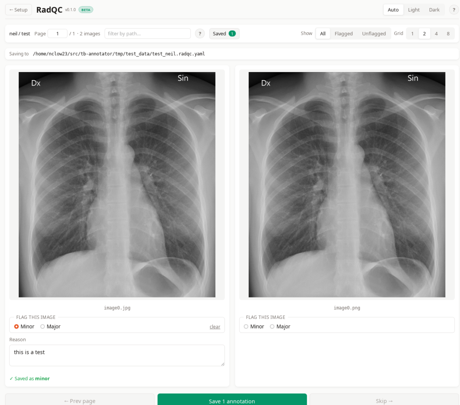 Grid view with two images per page
