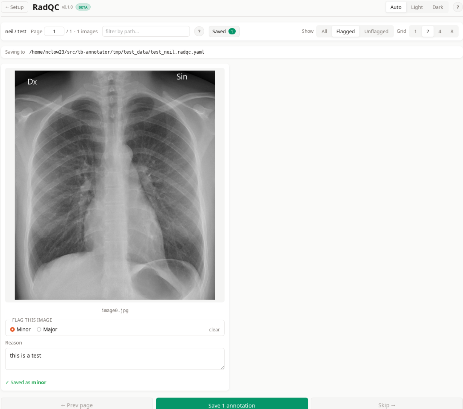 Filter set to Flagged showing only annotated images