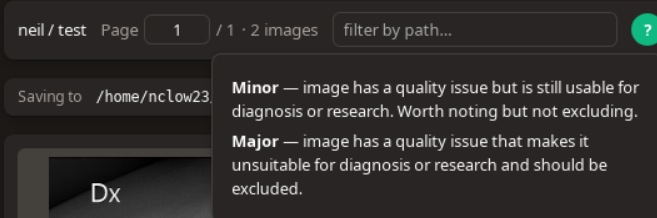 Help popover defining Minor and Major